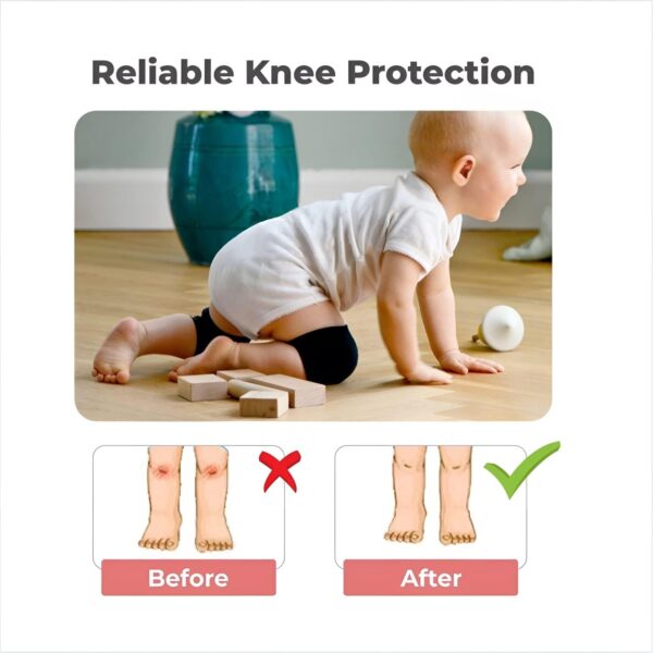 Baby Knee Pad Multicolour - Image 5